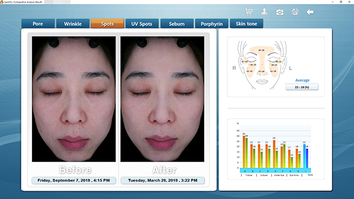 Comparative Analysis