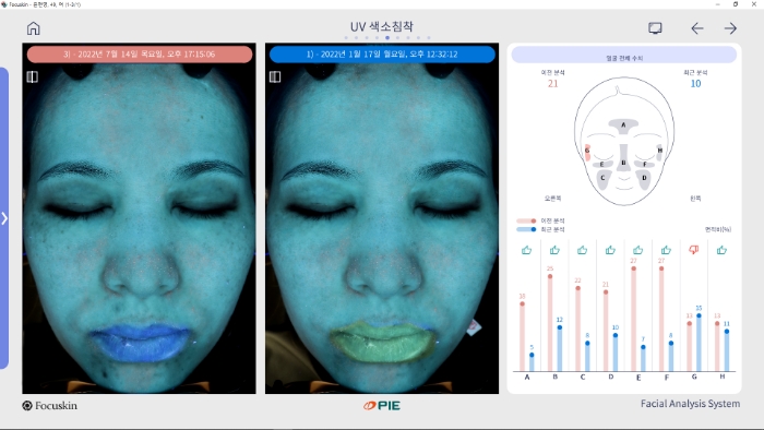 비교 분석(상세)