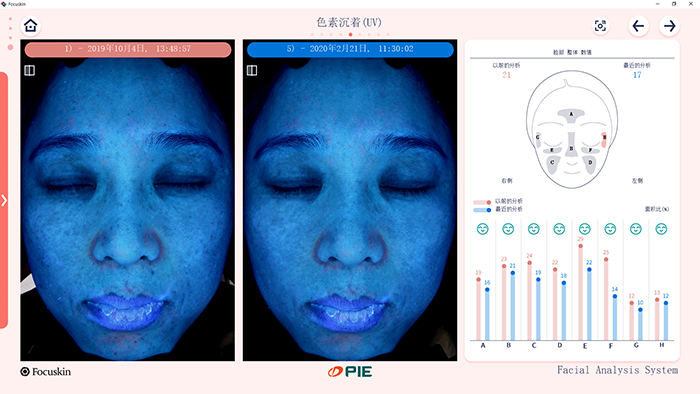 比较分析 （详细）