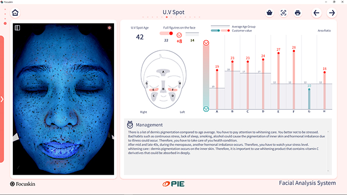 UV Pigmentation