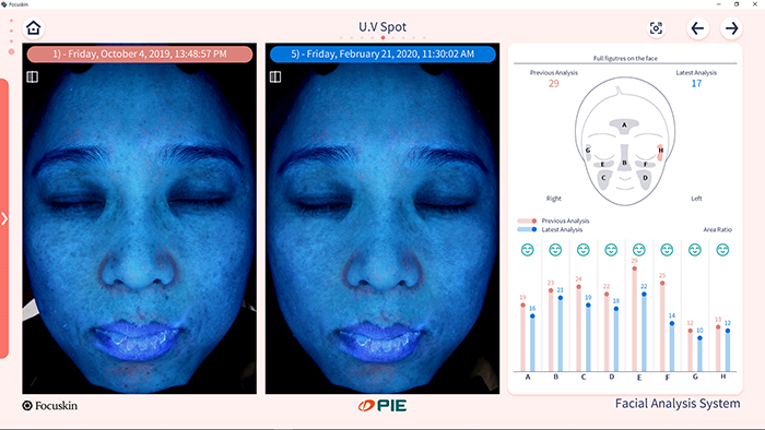 Comparison analysis(detail)
