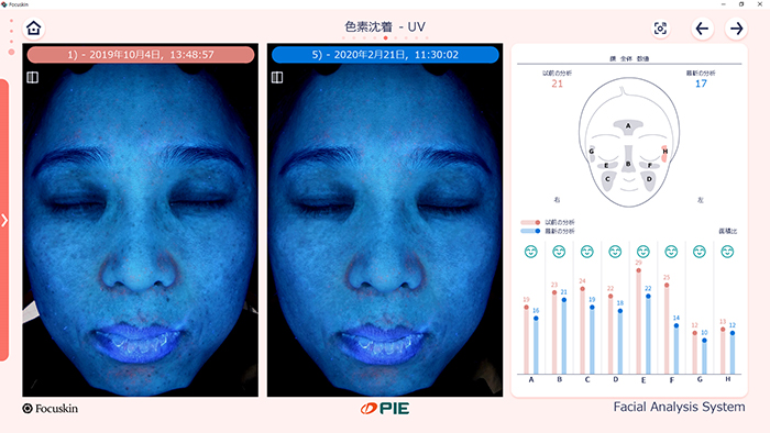 比較分析（詳細）
