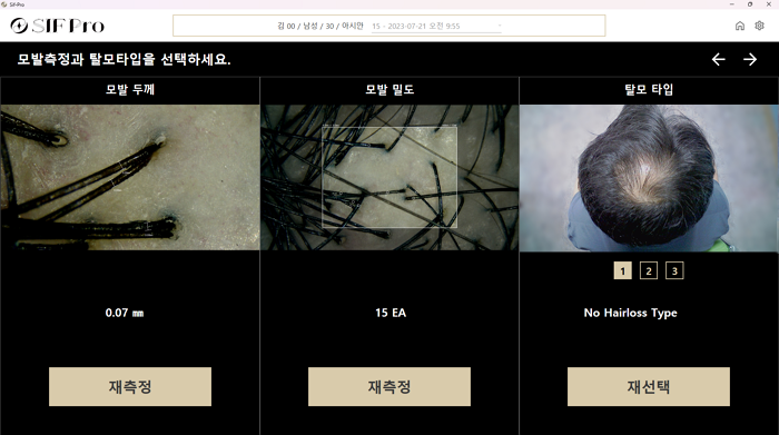 모발 측정