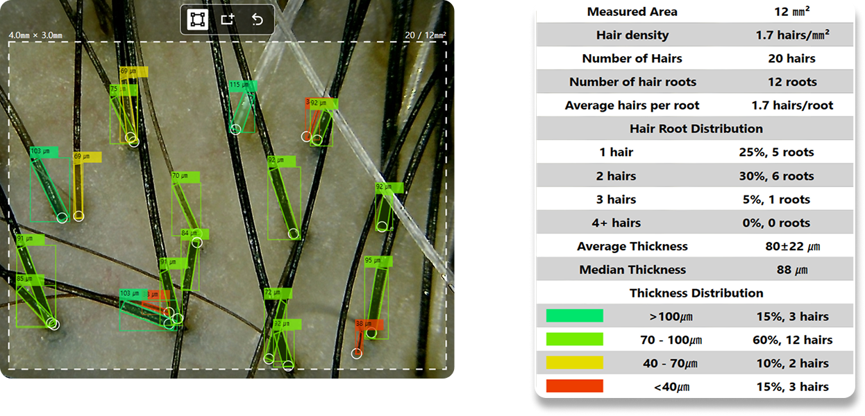 auto_measured_AI_eng
